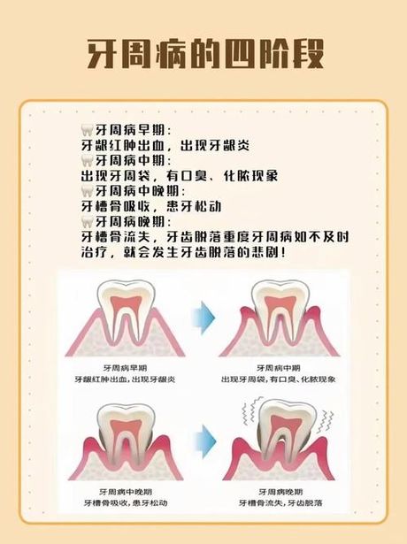 咬肌间隙：引发口腔疾病的隐形“杀手”