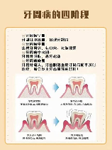 咬肌间隙：引发口腔疾病的隐形“杀手”